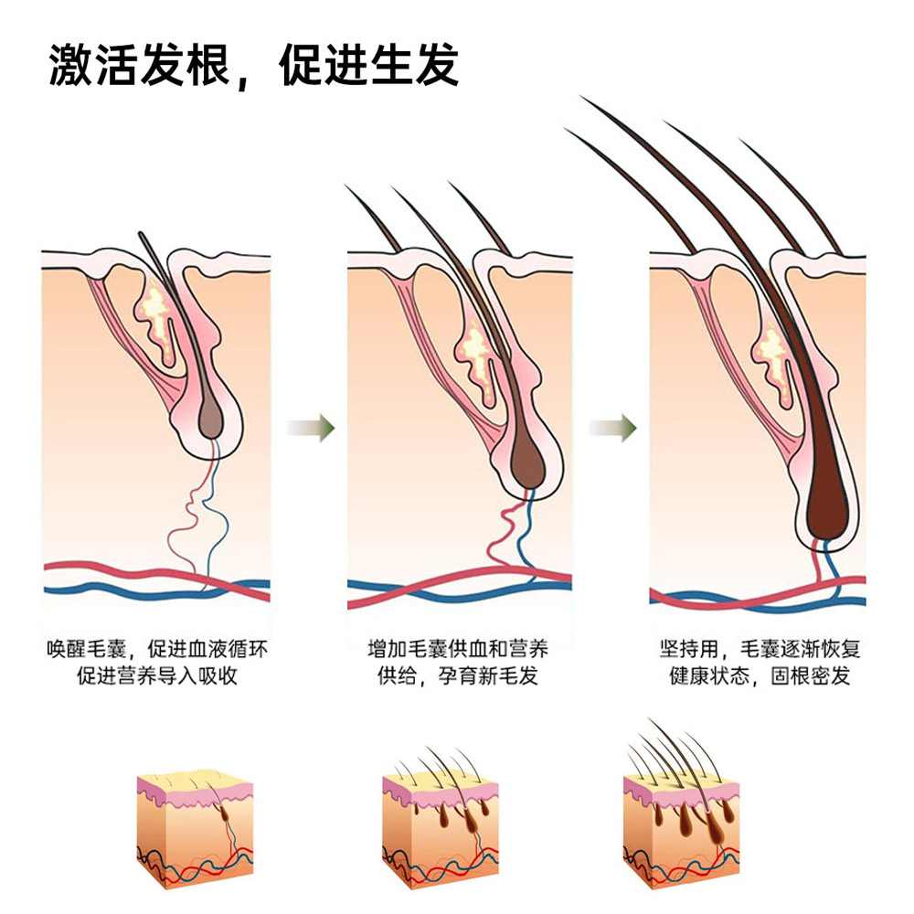AWE 2025 前沿观察：家用美容仪的技术升级与市场新趋势（images 3）