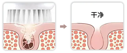 声波洁面仪（images 40）