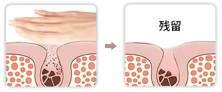 声波洁面仪（images 41）