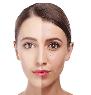 声波洁面仪（images 22）