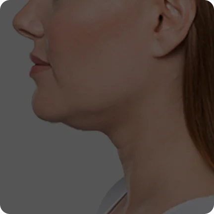 二合一等离子美容仪（images 16）