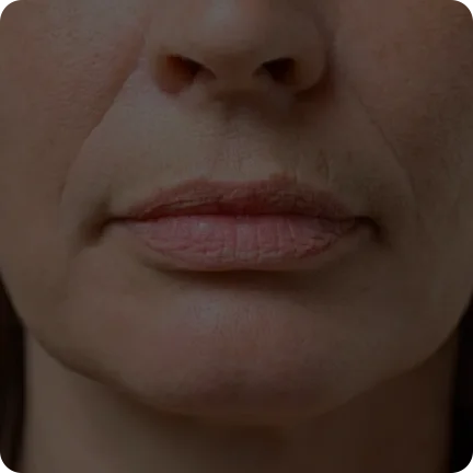 二合一等离子美容仪（images 15）