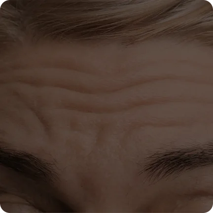 二合一等离子美容仪（images 17）