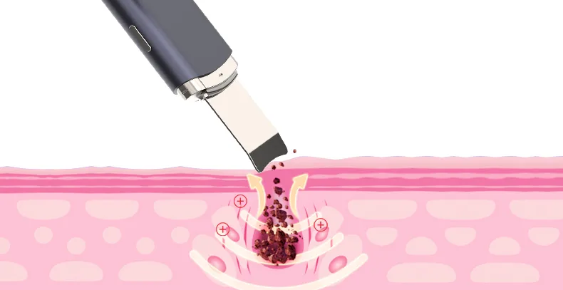 超声波铲皮机（images 15）