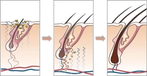 微电流健发梳(images 7)