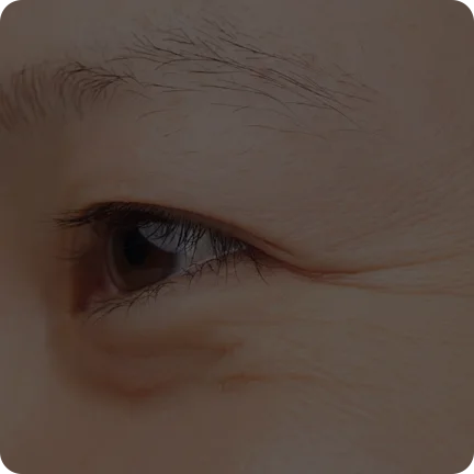 EMS面部按摩仪（images 18）