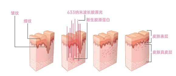 面罩美容仪(images 19)