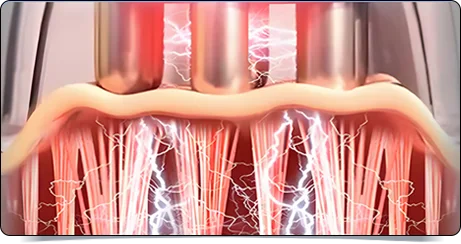 EMS美容美体仪（images 17）