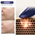 Nano Ionic Facial Steamer