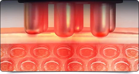 EMS美容美体仪（images 21）