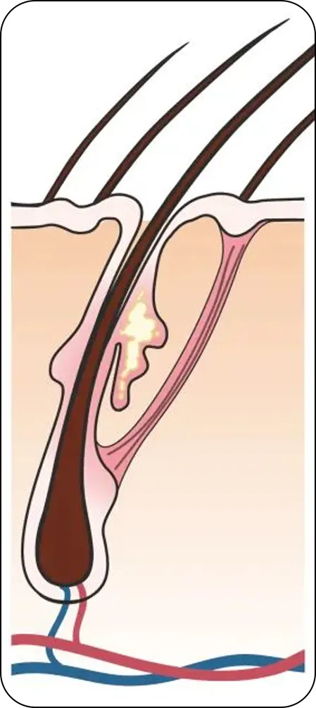 便携微电流梳子(images 16)