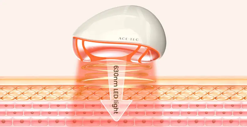 电穿孔美容仪(images 10)