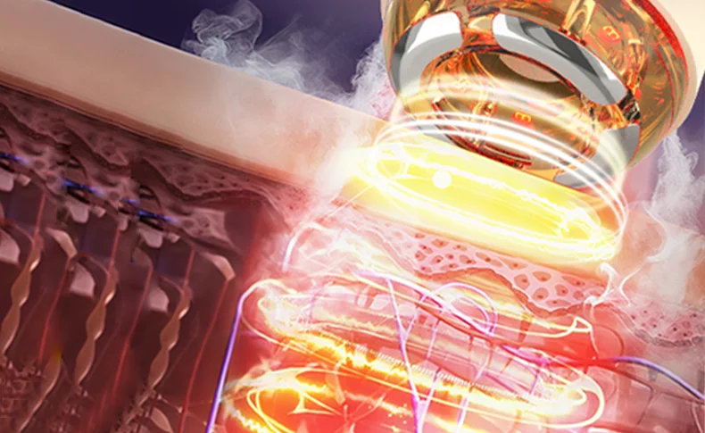 提拉紧致美容仪(images 6)