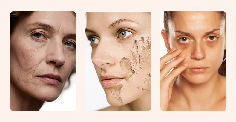 电穿孔美容仪(images 7)