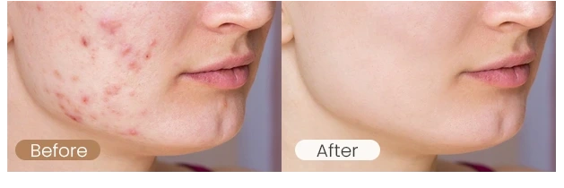 多光谱面罩（images 23）