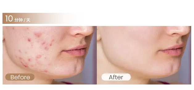 多光谱面罩（images 16）