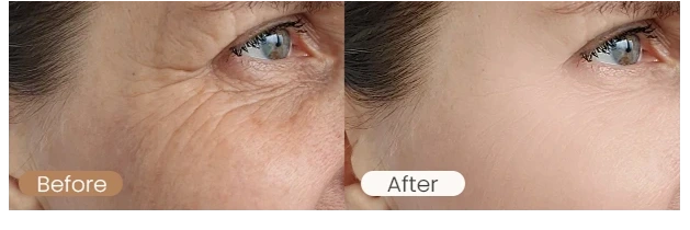 多光谱面罩（images 21）