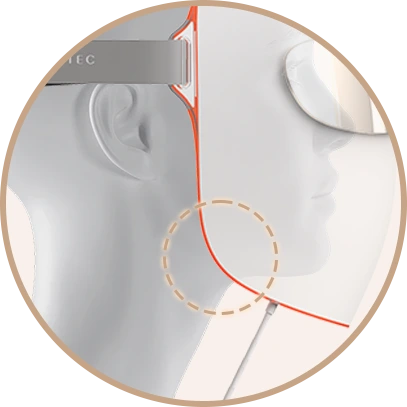 透气开放式结构